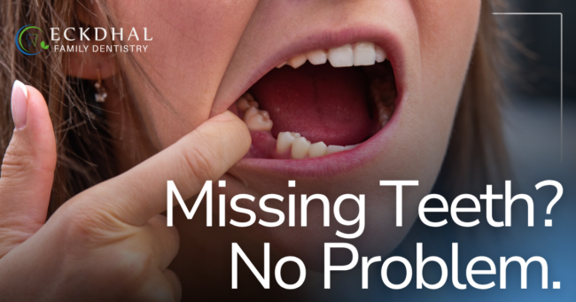 Missing Teeth? No Problem. girl pointing to missing tooth