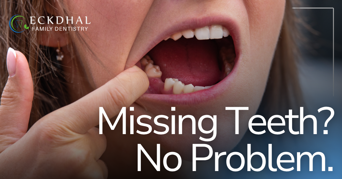 Missing Teeth? No Problem. girl pointing to missing tooth