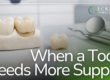 dental crowns