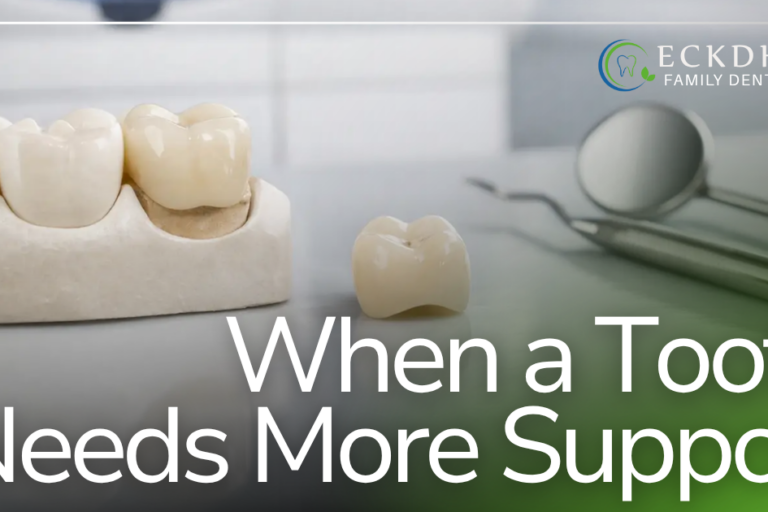 dental crowns
